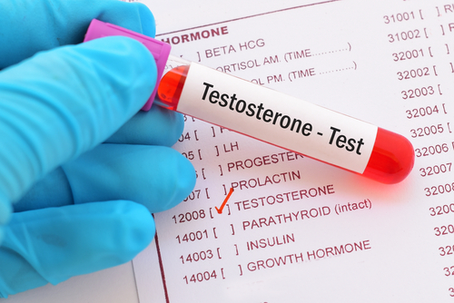 The National Library of Medicine defines testosterone as “the primary male hormone responsible for producing male sex characteristics.”
